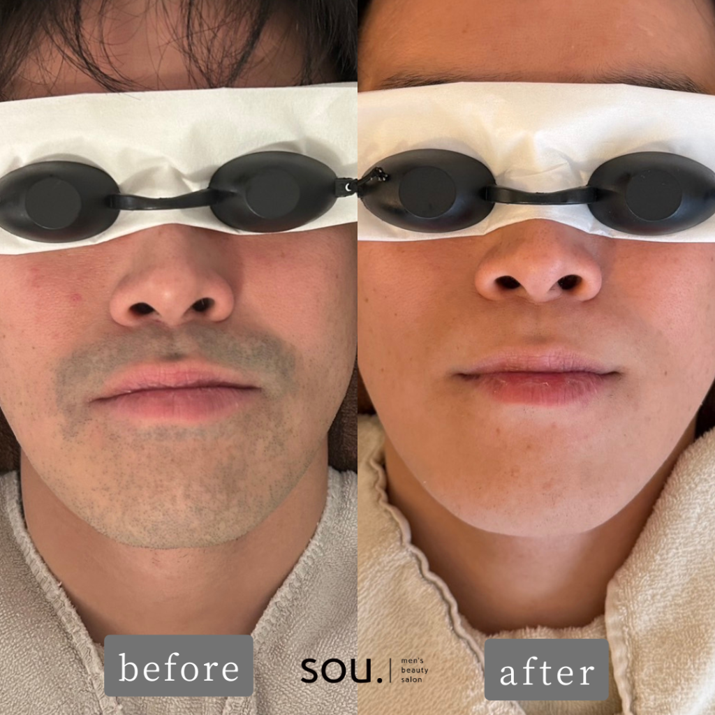 あるお客様の本当にあった実体験です！