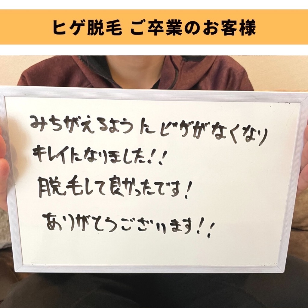 ＼ヒゲ脱毛ご卒業されたお客様です／